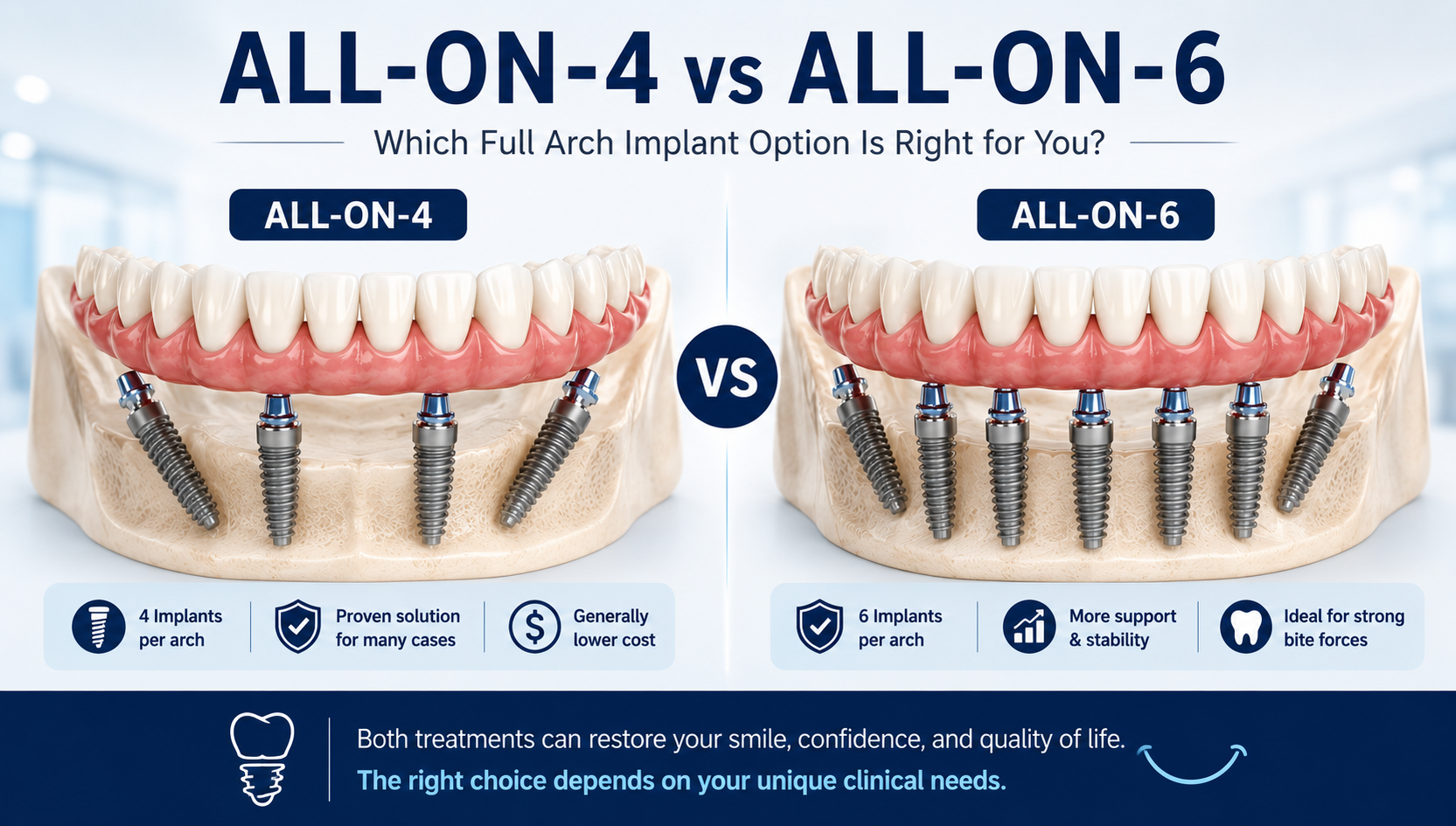 All-on-4 vs All-on-6 dental implants abroad