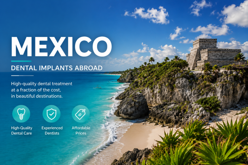 Dental Implants Mexico