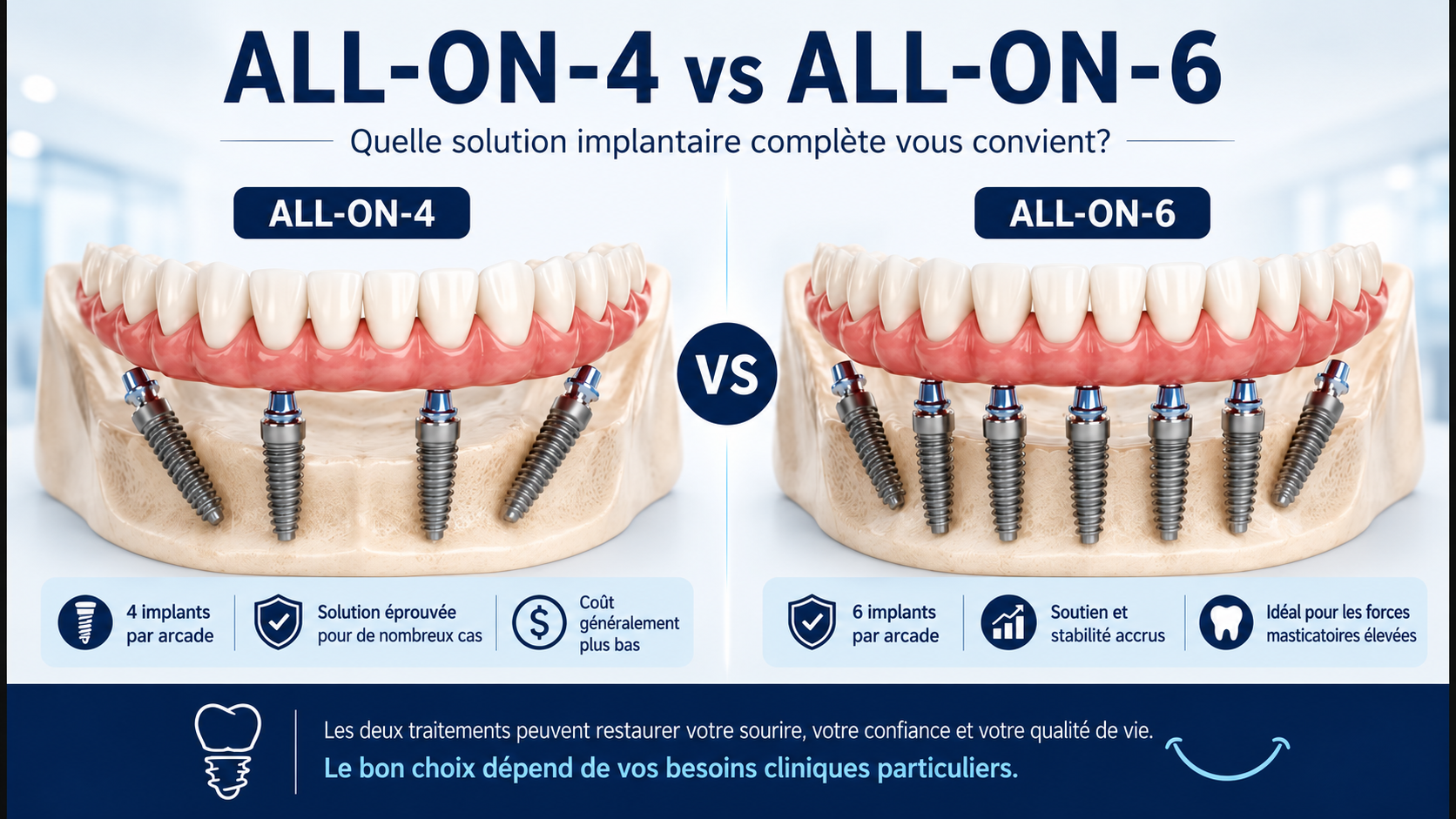 Comparaison des traitements All-on-4 et All-on-6 à l’étranger