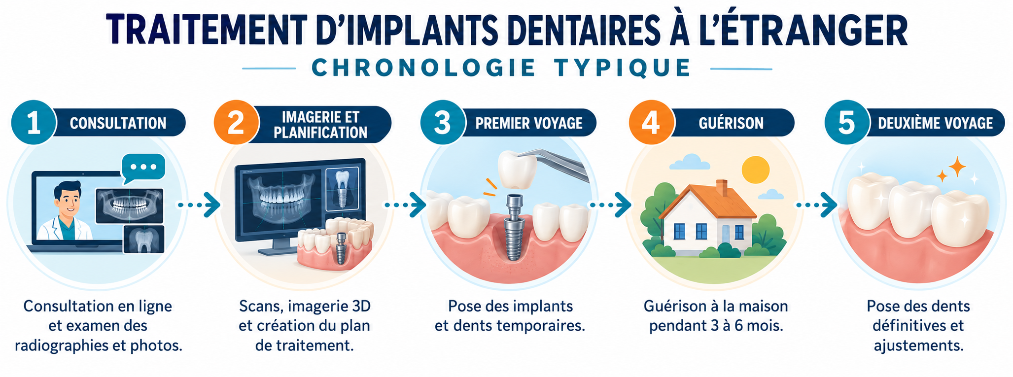 Chronologie d’un traitement implantaire à l’étranger