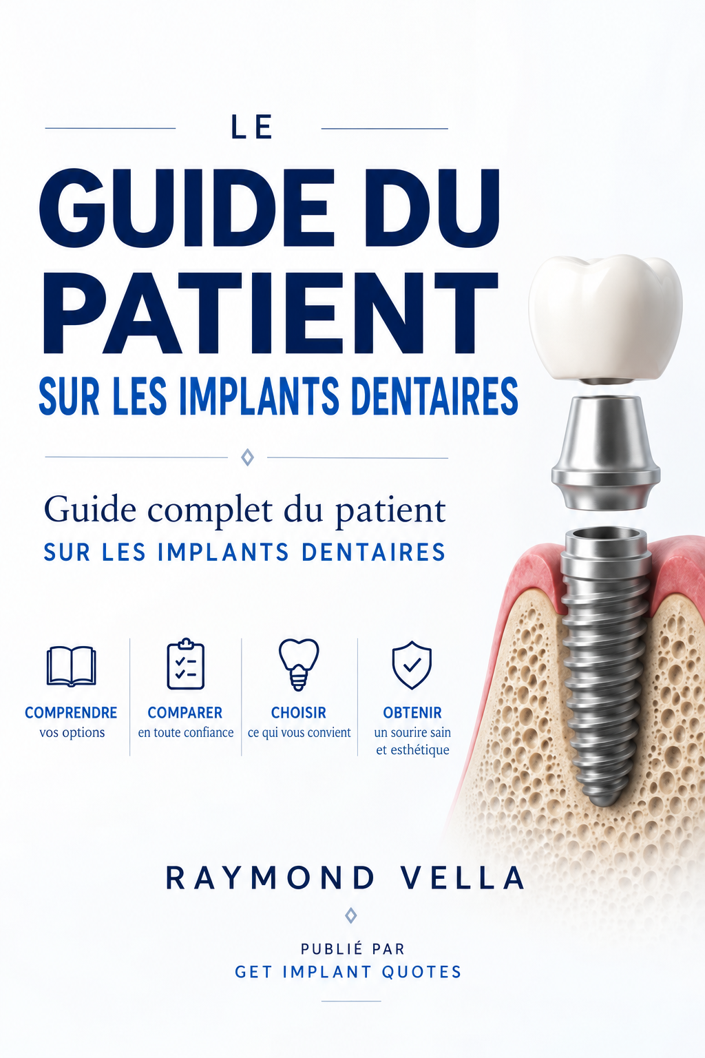Couverture du Guide du patient sur les implants dentaires